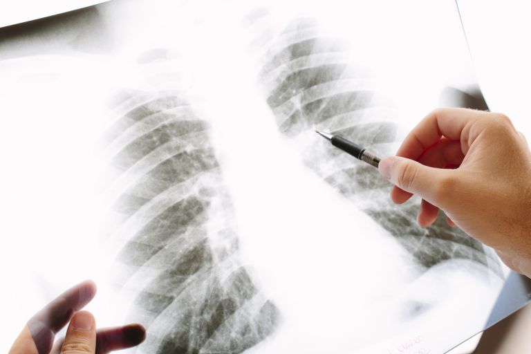 渋谷発都市ライフに根付く現代の歯科検診習慣と健康維持の新常識